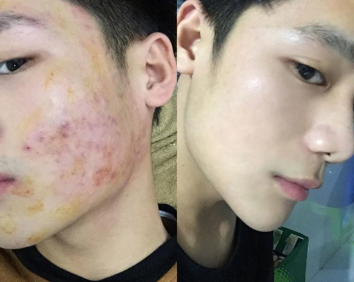 Chàng trai quyết tâm thay đổi ngoại hình để theo đuổi ước mơ và cái kết trở thành mỹ nam vạn người mê ảnh 6