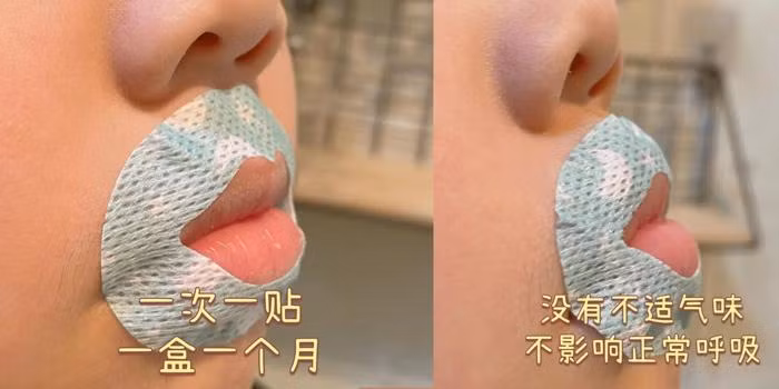 Miếng dán miệng chỉ tổ gây ngạt thở, tổn thương tế bào vì thiếu oxy.