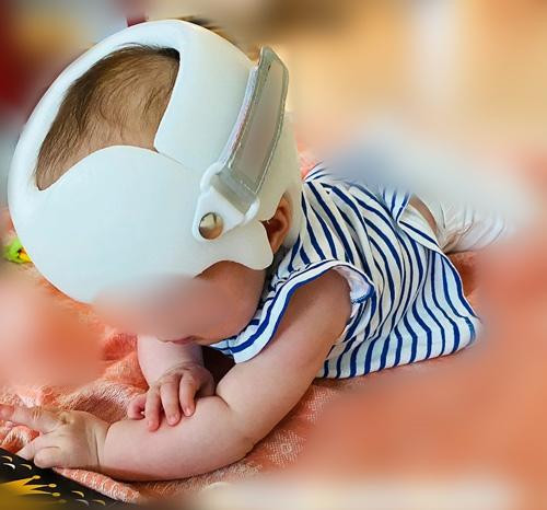 Mũ định dạng đầu chỉ nên dùng dưới sự chỉ định và giám sát của bệnh viện. Mũ định dạng đầu chỉ nên dùng dưới sự chỉ định và giám sát của bệnh viện.