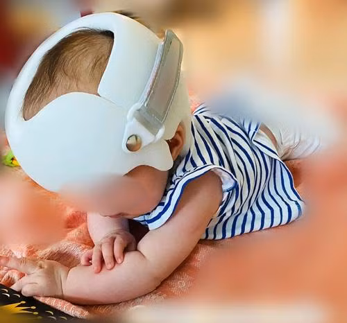 Mũ định dạng đầu chỉ nên dùng dưới sự chỉ định và giám sát của bệnh viện.