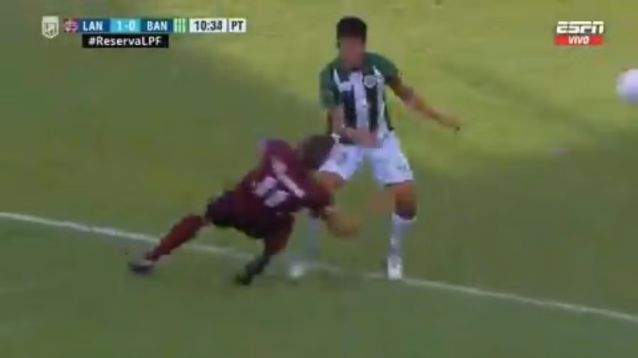 Juan Pablo Krilanovich bị bóng đập vào mặt.