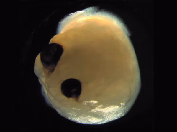 Não bộ có mắt.