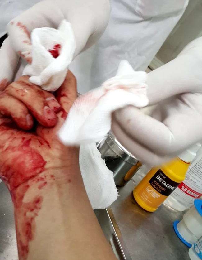 Nhà báo Đỗ Doãn Hoàng bị ba đối tượng lạ mặt dùng gậy đánh dã man
