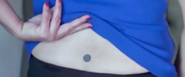 Người phụ nữ có thể hút nam châm vào lưng Người phụ nữ có thể hút nam châm vào lưng