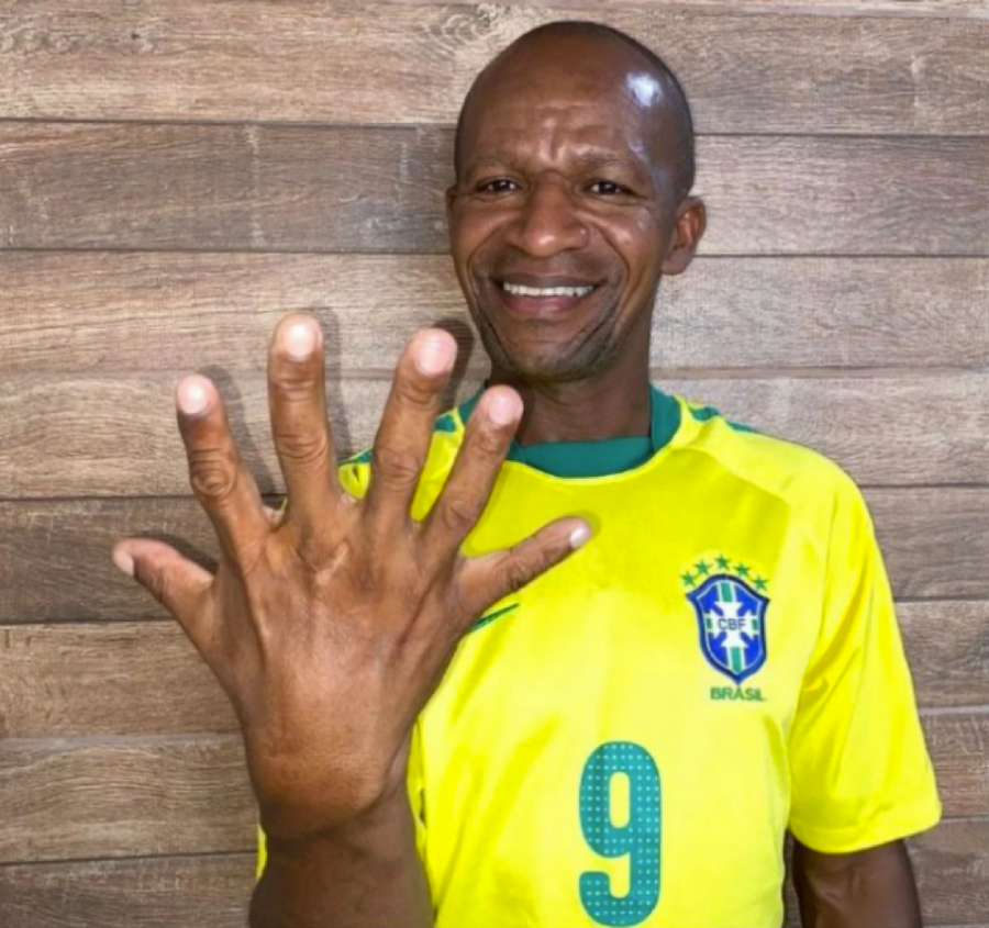 Cổ động viên Josevaldo de Almeida Thome đang hy vọng số lần vô địch World Cup của Brazil sẽ bằng số ngón tay trên một bàn tay của anh. Cổ động viên Josevaldo de Almeida Thome đang hy vọng số lần vô địch World Cup của Brazil sẽ bằng số ngón tay trên một bàn tay của anh.