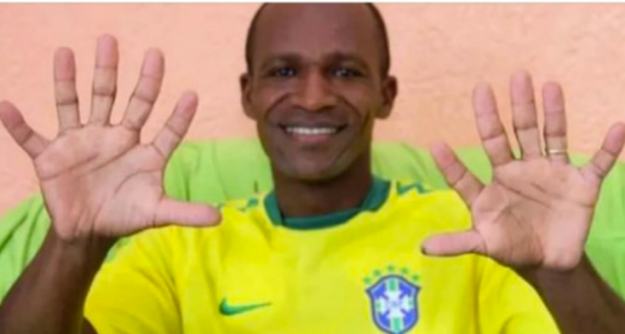 Cổ động viên đặc biệt của Brazil khoe mỗi bàn tay có 6 ngón tay. Cổ động viên đặc biệt của Brazil khoe mỗi bàn tay có 6 ngón tay.