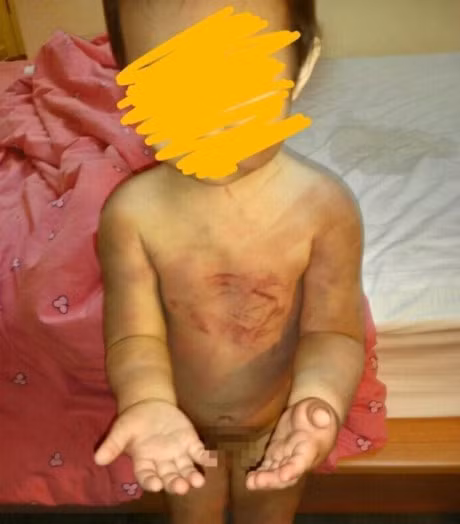 Cha ruot bao hanh con gai 2 tuoi roi gui anh 