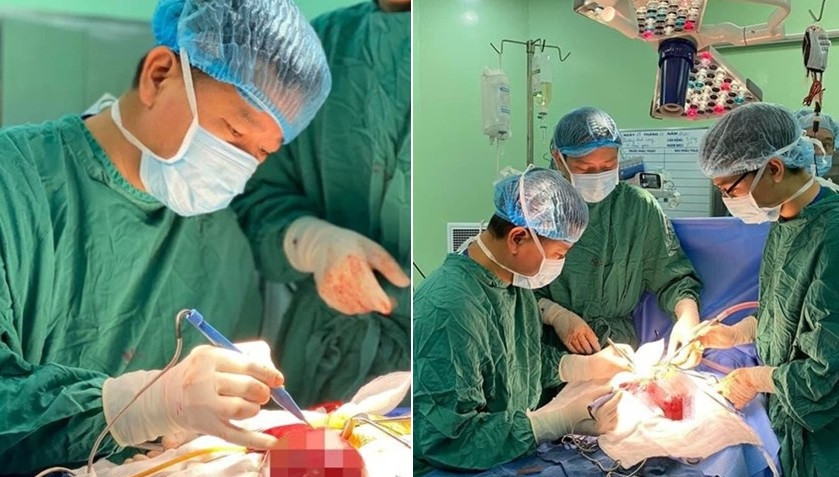 Đại phẫu khối u máu trong gan cho bé 14 ngày tuổi 