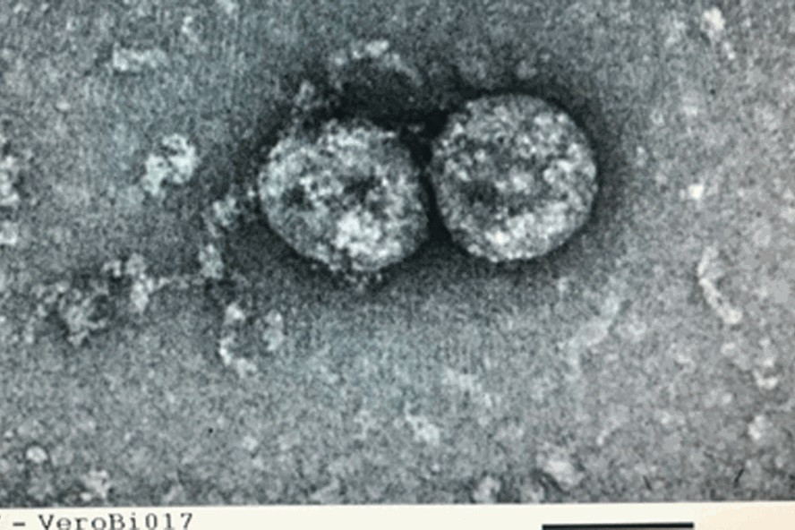 Chủng virus SARS-CoV-2 mà Việt Nam đã phân lập và nuôi cấy từ đầu dịch COVID-19. Ảnh: Viện VSDT TƯ.