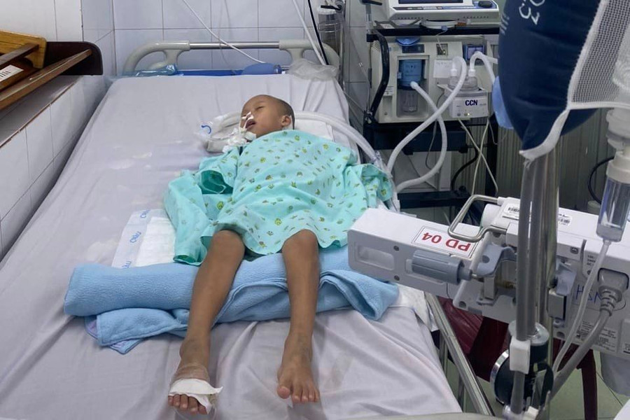 Cháu Phương Thảo hôn mê trong Bệnh viện Nhi đồng II (TP HCM) gần 2 tháng nay.