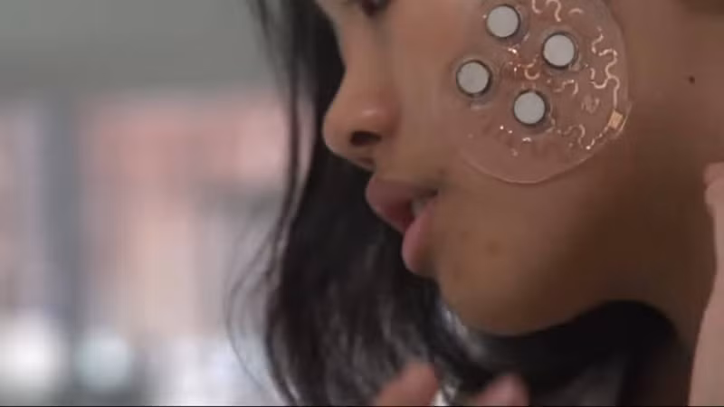 Miếng dán chuyển thuốc qua da có thể chữa trị một số bệnh về da. Ảnh: MIT.