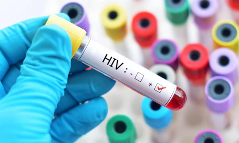 Bất ngờ sức khỏe của người nhiễm HIV đầu tiên ở Việt Nam 