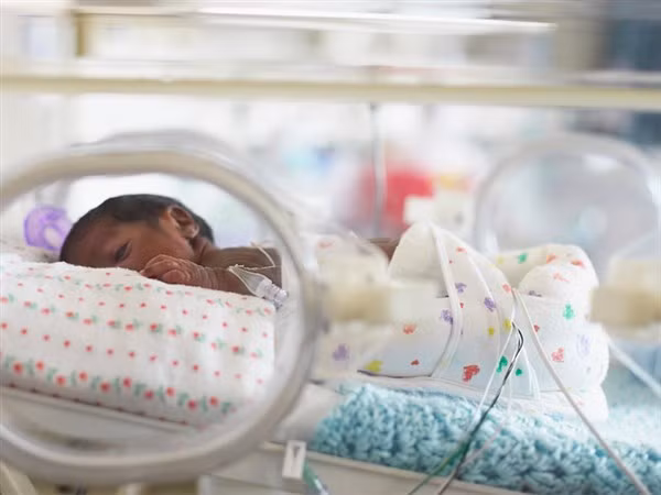 Trẻ sinh non trong lồng kính.