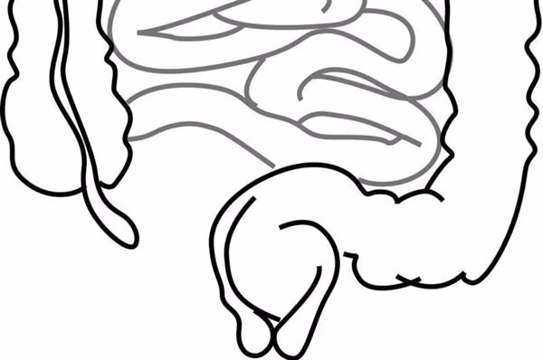 Các nhà khoa học đã nghiên cứu 184 mẫu khối u và hồ sơ bệnh án của người mắc ung thư ruột.