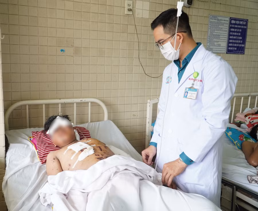 Nạn nhân còn lại của vụ tai nạn do pháo nổ được điều trị tại Bệnh viện Chợ Rẫy. Ảnh: BVCC.