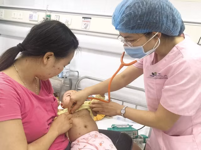 Điều trị trẻ mắc thủy đậu tại Bệnh viện Nhi Trung ương. Ảnh: BVCC.