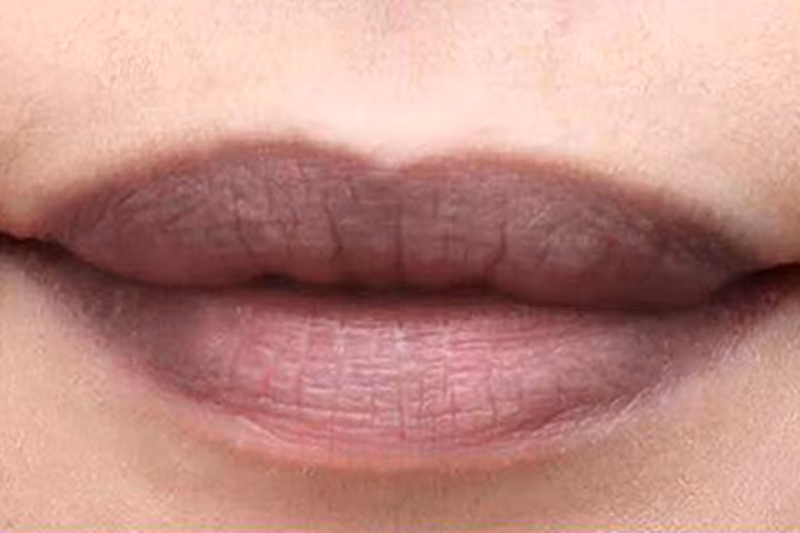 Môi thâm trở nên hồng hào với hỗn hợp mật ong chanh