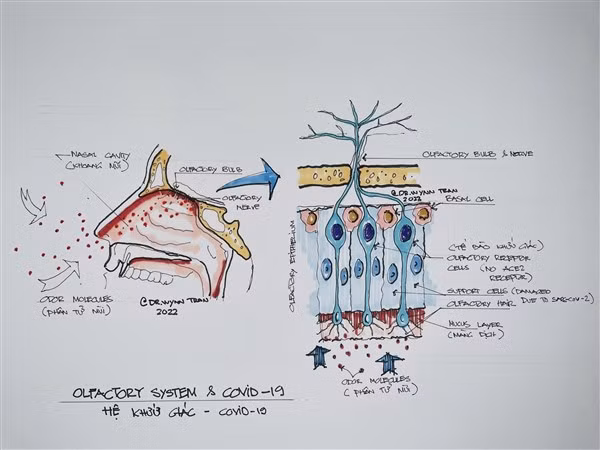 Sơ đồ về hệ khứu giác và tác động của Covid-19. Ảnh: PGS.TS Trần Huỳnh.