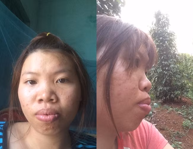 Phượng Thị Nở có thời gian từng "làm mưa làm gió" khắp các trang mạng Việt Nam với câu chuyện về cuộc đời và nhan sắc của Phượng.