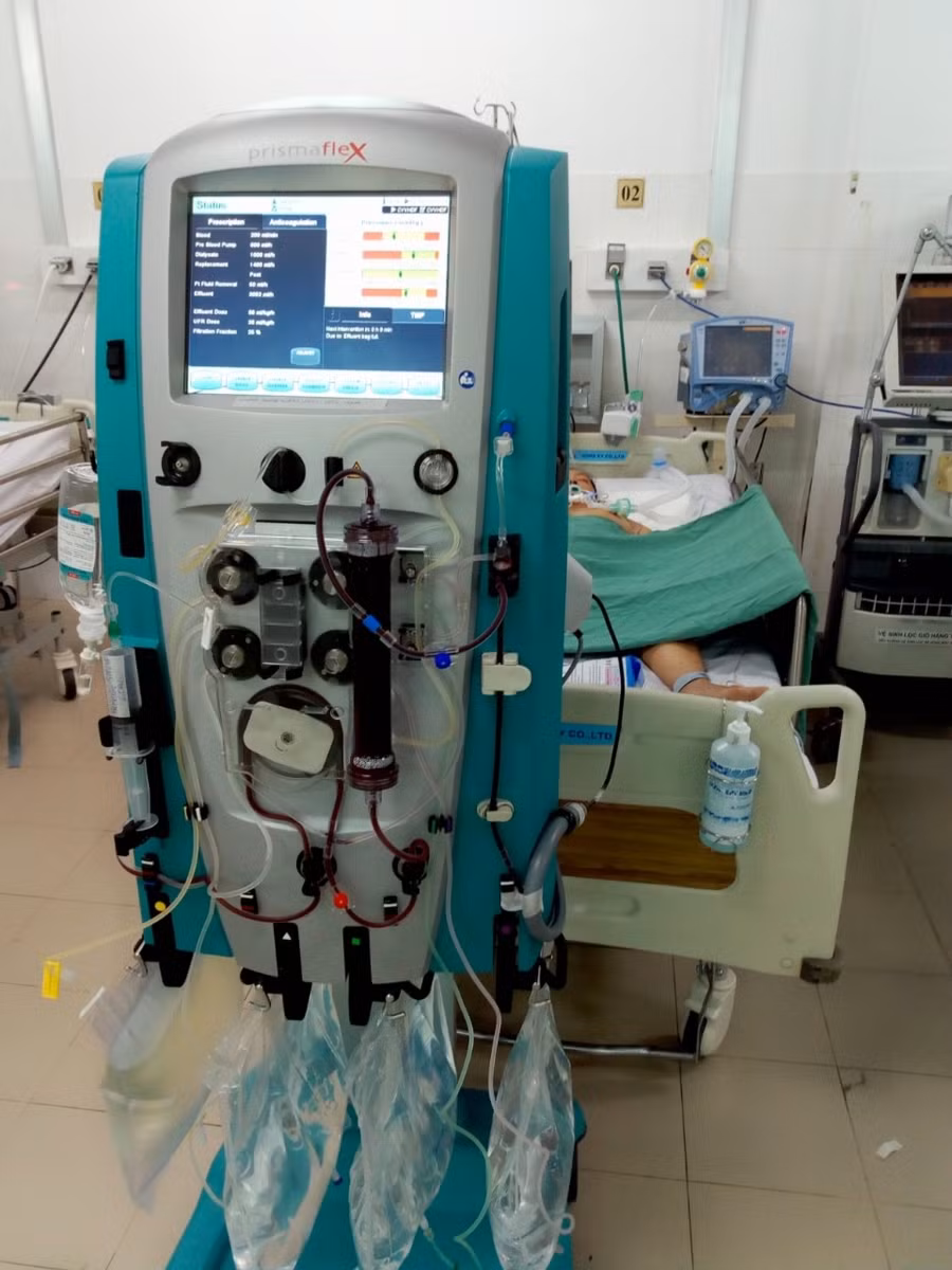 Hình lọc máu liên tục tại khoa hồi sức tích cực. Ảnh: BVCC.