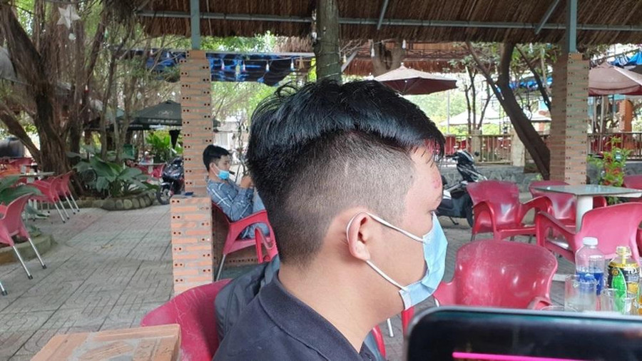 Vụ việc khiến anh K. bị thương ở phần đầu và tay. Ảnh: AX. Vụ việc khiến anh K. bị thương ở phần đầu và tay. Ảnh: AX.