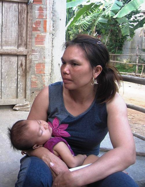 Sự thật về bé gái bị bỏng rộp toàn thân, suýt chết vì uống nước ngọt - Ảnh 3 Sự thật về bé gái bị bỏng rộp toàn thân, suýt chết vì uống nước ngọt - Ảnh 3