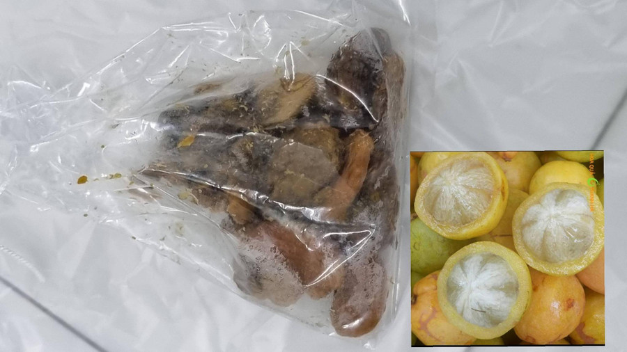 Hạt quả bứa được lấy ra từ bụng bệnh nhân. Ảnh: BVCC.