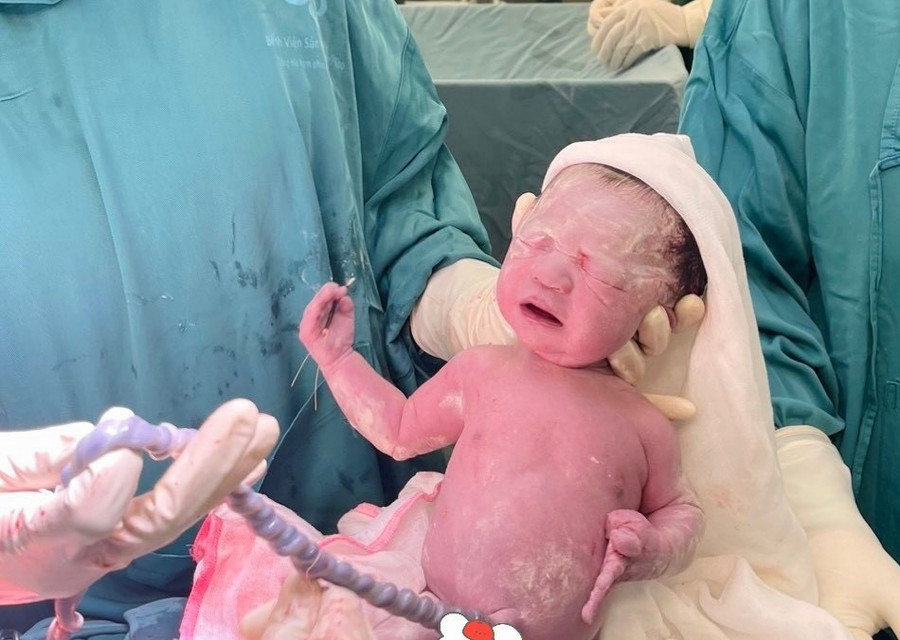 Sức khỏe của 2 em bé bình thường, đây là trường hợp trùng hợp hi hữu tại Bệnh viện Sản Nhi Phú Thọ.