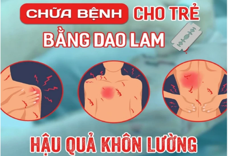 Dùng dao lam nặn (hoặc rạch) lấy máu để chữa bệnh là phương pháp hoàn toàn không có tính khoa học. Ảnh minh họa