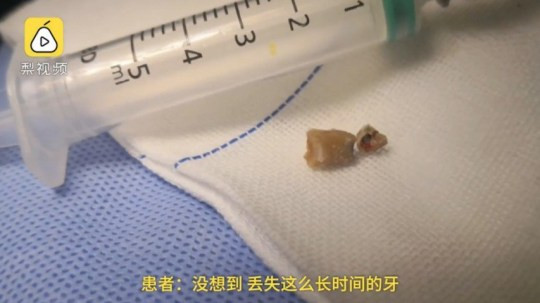 Sức khỏe anh Zhang đang hồi phục sau phẫu thuật. Sức khỏe anh Zhang đang hồi phục sau phẫu thuật.