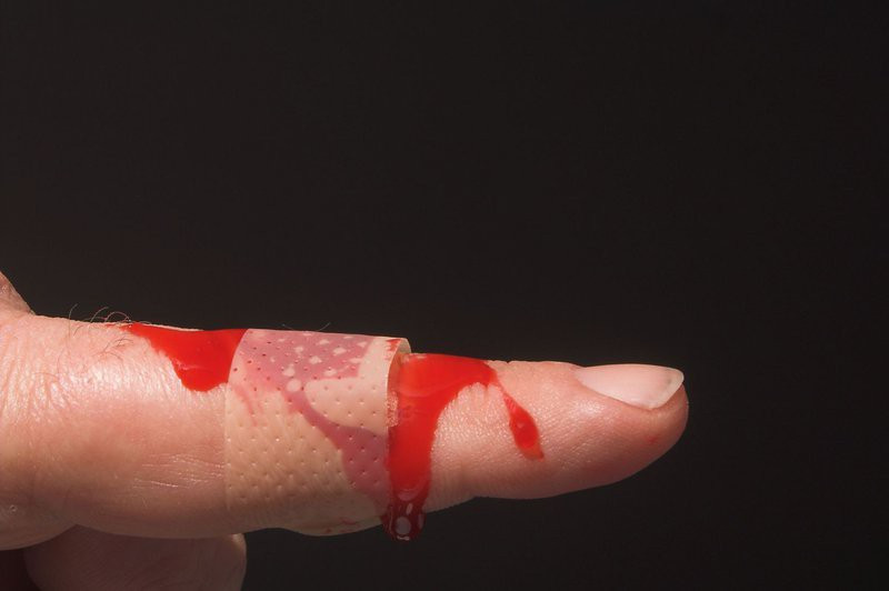 Nam thanh niên "tốn" nhiều tiền bảo hiểm nhất Việt Nam và căn bệnh nhà giàu cũng sợ - Ảnh 1. Nam thanh niên "tốn" nhiều tiền bảo hiểm nhất Việt Nam và căn bệnh nhà giàu cũng sợ - Ảnh 1.