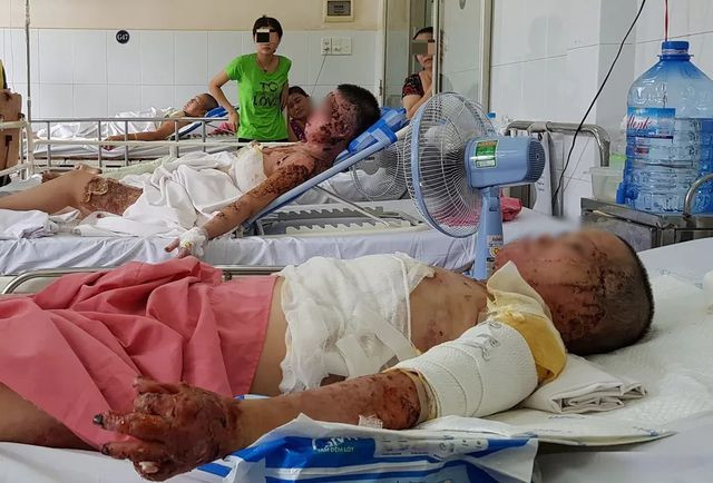 Vợ thành “đuốc sống” vì điếu thuốc lá của chồng - 2 Vợ thành “đuốc sống” vì điếu thuốc lá của chồng - 2