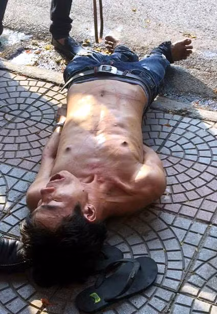 Nam thanh niên nằm trên vỉa hè, miệng trệu trạo, nghiến răng ken két.