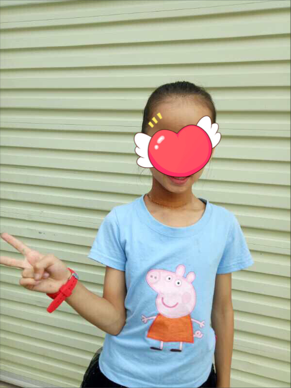 Bệnh nhân sau mổ 7 ngày