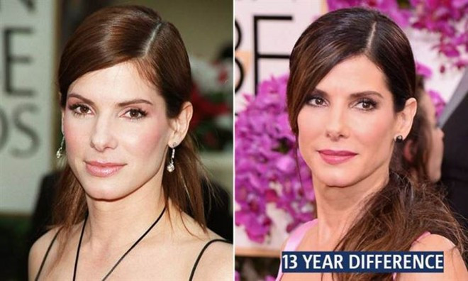 Với cùng một góc chụp nhưng gương mặt sau 13 năm của nữ diễn viên gạo cội Sandra Bullock không có nhiều thay đổi. Một trong những bí quyết giữ gìn sắc đẹp của cô là cá tính hài hước và lối sống lạc quan yêu đời. Hiện tại, người đẹp 50 tuổi rất hạnh phúc bên bạn bè và cậu con trai Louis. Những sao Hollywood không hề thay đổi sau hơn 10 năm