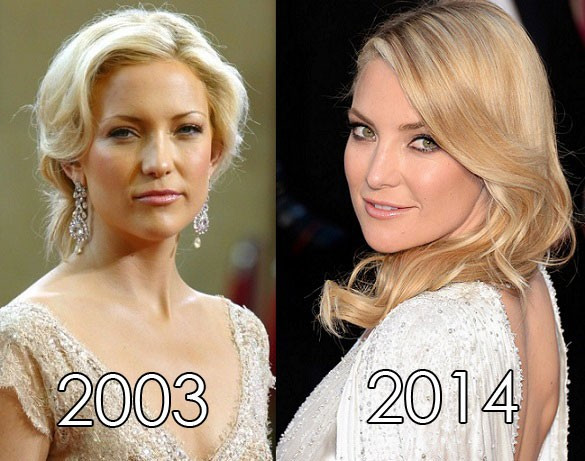 Vốn dành rất nhiều thời gian cho sự nghiệp diễn xuất và ca hát nhưng chưa bao giờ người ta thấy vẻ già nua trên khuôn mặt Kate Hudson. Dù không hề sử dụng bất cứ một loại thuốc hay chế độ ăn kiêng nào nhưng Kate vẫn giữ được vẻ tươi trẻ của mình nhờ sự hiểu biết về các loại thực phẩm cũng như dành thời gian luyện tâp để giữ gìn sức khỏe và thân hình cân đối. Những sao Hollywood không hề thay đổi sau hơn 10 năm