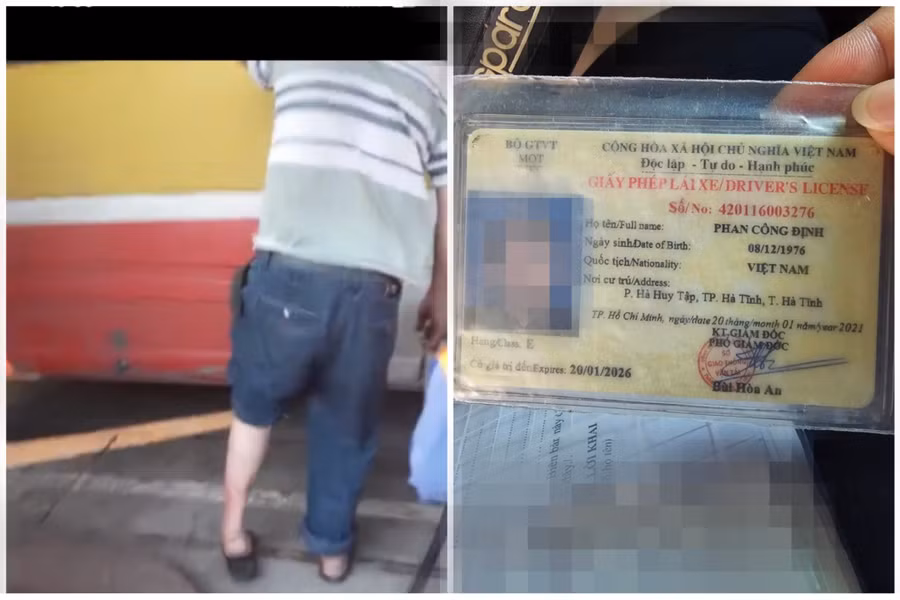 Tài xế xe buýt "nhái" vẫn mặc dù khuyết tật ở chân nhưng vẫn được cấp bằng lái xe hạng E.