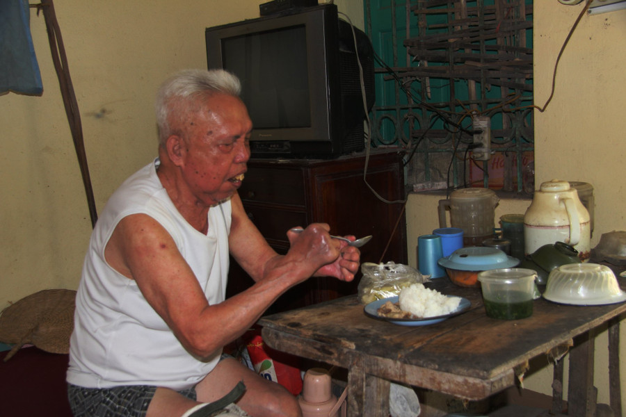 Bệnh phong khiến một số bộ phận trên cơ thể bị biến dạng gây khó khăn trong sinh hoạt. Bệnh phong khiến một số bộ phận trên cơ thể bị biến dạng gây khó khăn trong sinh hoạt.