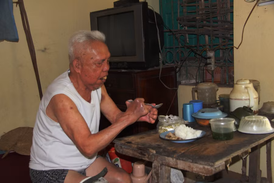 Bệnh phong khiến một số bộ phận trên cơ thể bị biến dạng gây khó khăn trong sinh hoạt.