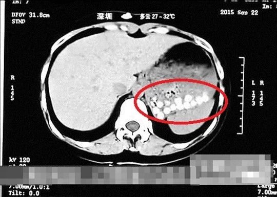 Truyền hình Trung Quốc: “Trân châu trà sữa làm từ da giày, lốp xe cũ“