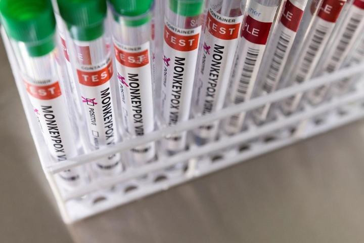 WHO cho rằng đậu mùa khỉ chưa phải là vấn đề y tế khẩn cấp. Ảnh minh họa: Reuters.