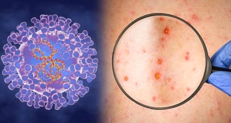 Ảnh minh họa/INT