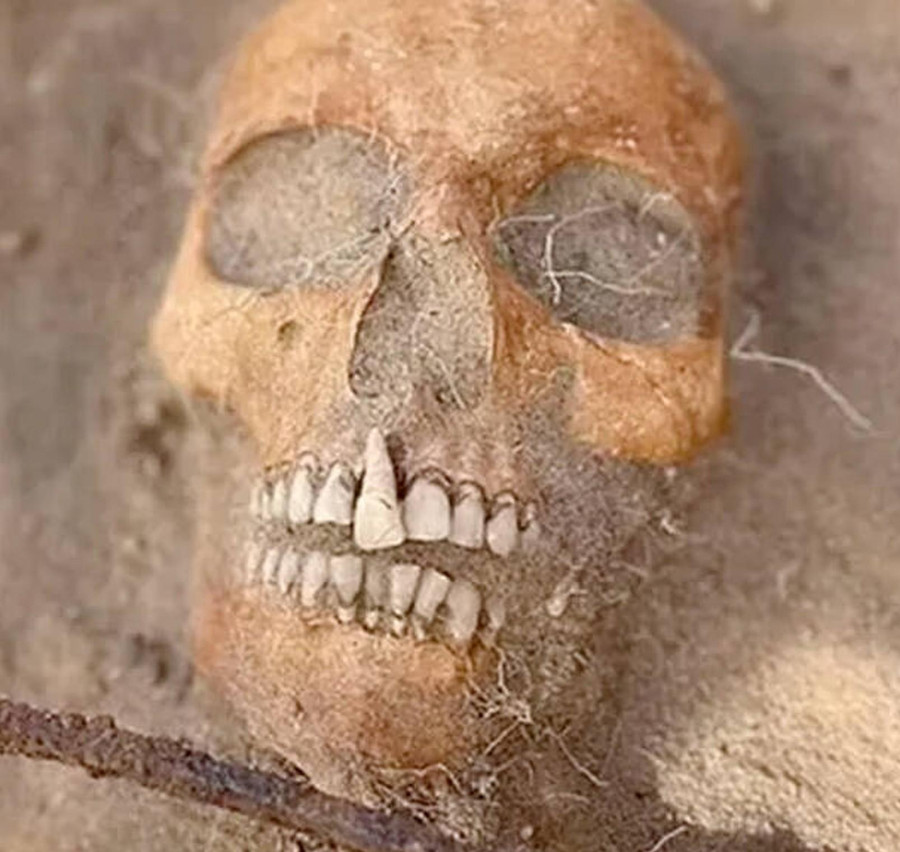 Chiếc răng khác thường của di hài bị nghi là &apos;ma cà rồng&apos;.