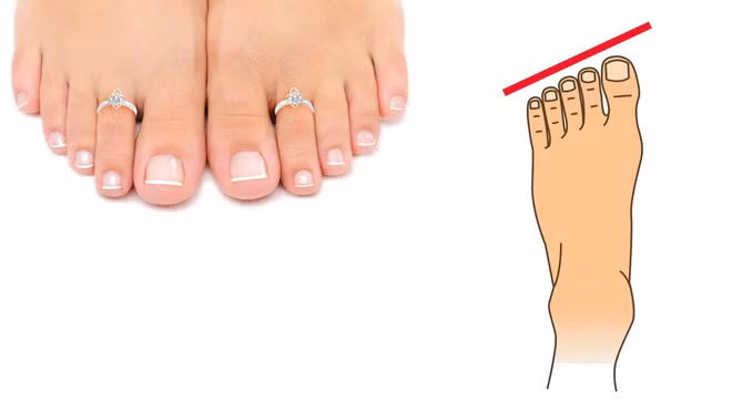 Ngón cái dài hơn những ngón chân khác giàu có.