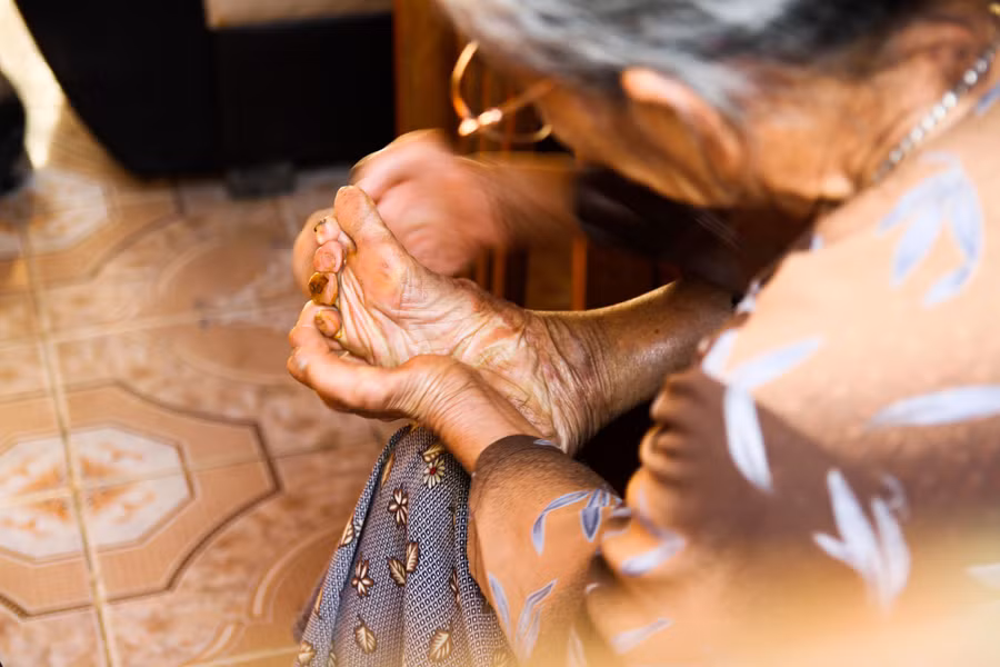 Chân và tay bà Sợi bị teo tóp, khòng khoèo và đơ cứng như khúc gỗ.