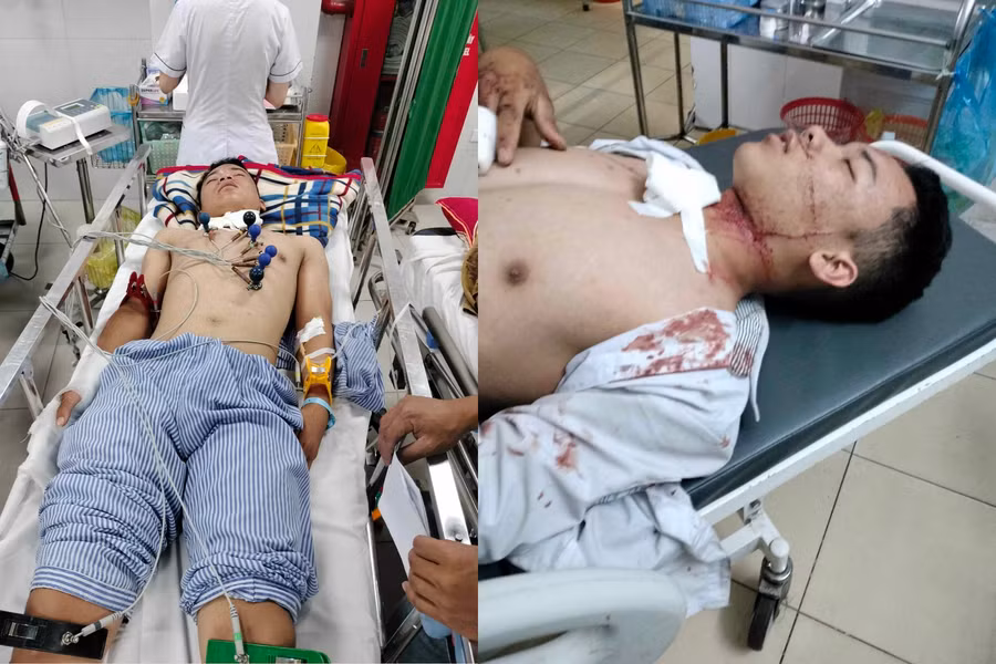 Em Bắc tại thời điểm cấp cứu ở Bệnh viện Việt Đức. (Ảnh: NNBN cung cấp)