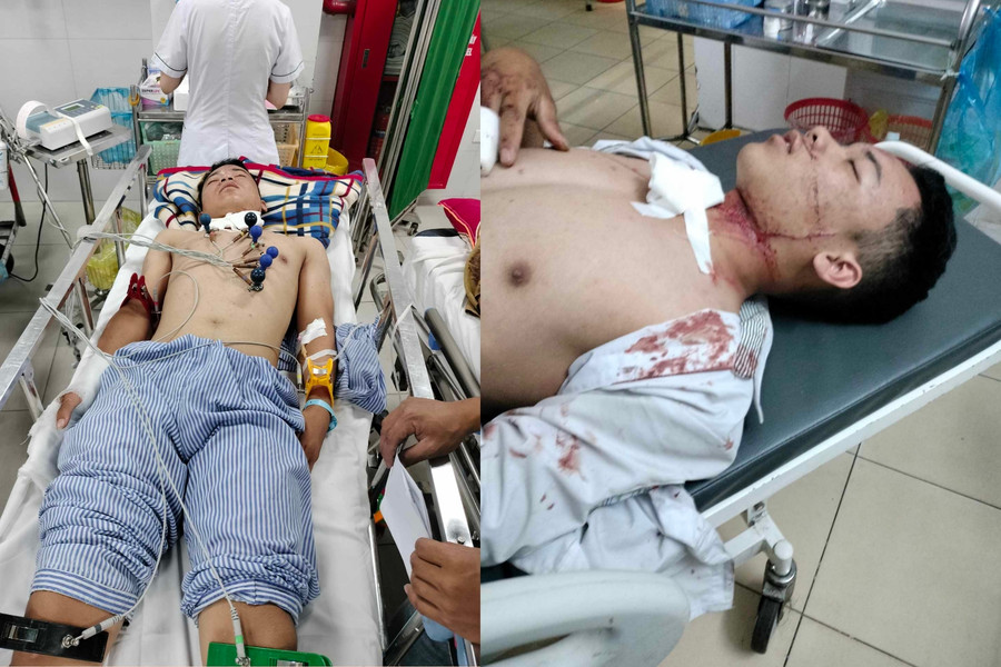 Em Bắc tại thời điểm cấp cứu ở Bệnh viện Việt Đức. (Ảnh: NNBN cung cấp) Em Bắc tại thời điểm cấp cứu ở Bệnh viện Việt Đức. (Ảnh: NNBN cung cấp)