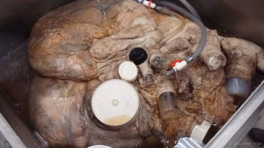 Xem quả tim nặng 180 kg