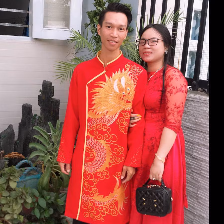 co gai xinh dep bi tat axit bien dang, ban trai 5 nam nhin thay chi noi dung 1 cau - 1