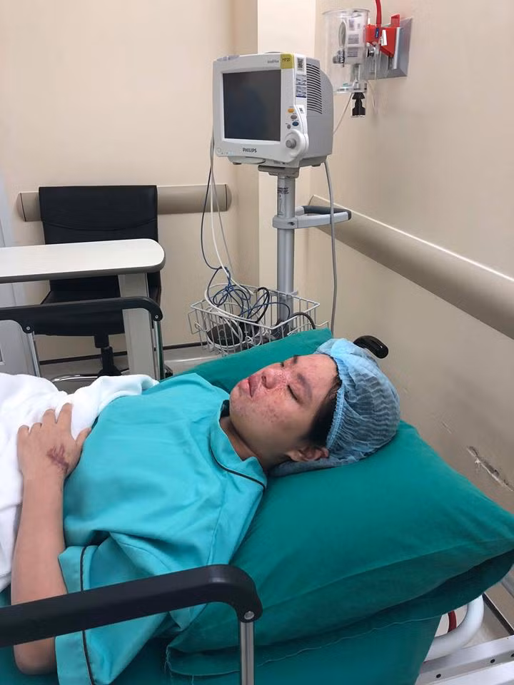 co gai xinh dep bi tat axit bien dang, ban trai 5 nam nhin thay chi noi dung 1 cau - 4